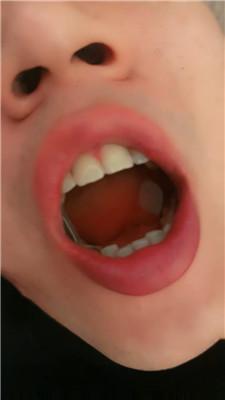 fq1ih40h5gu.jpg