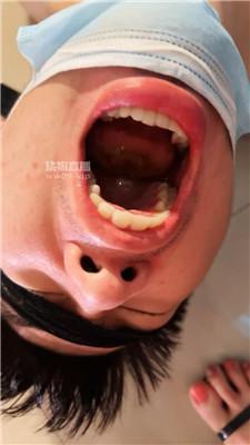 vudg0umf5mg.jpg