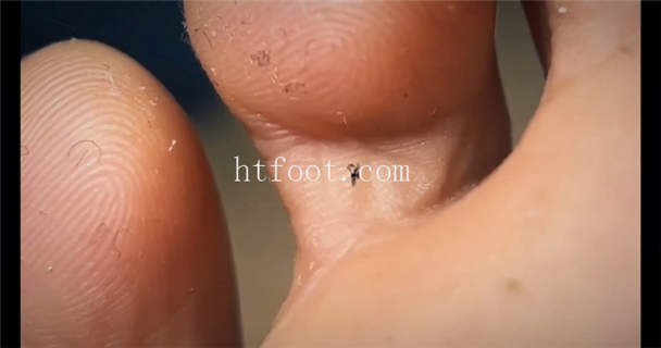 063245mvtz30r0d2hiwitt.jpg