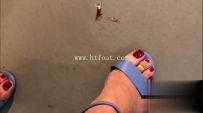 23140 女巨人马德琳| “惊人的小蜘蛛| 足部粉碎，对接，穿线