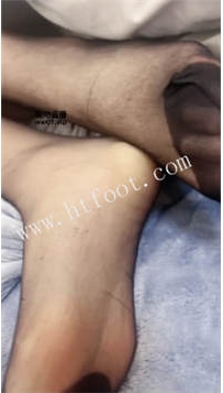 ZB4348 拉克丝】弟弟竟是M35分钟