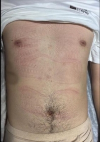 女S板鞋帆布鞋长时间站立踩踏，满身鞋印 ACYC-5054